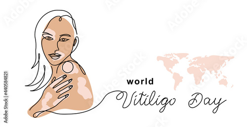 World vitiligo day vector banner, poster, background. Woman with patches skin. One continuous line art drawing with lettering vitiligo day
