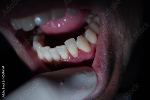 dentist wearing white gloves opening man's mouth for treatment