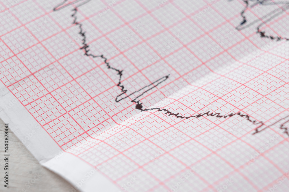 Heart electrocardiogram EKG chart on special paper. Concept for heart scan, health insurance, medical background, examination. Heart electrocardiogram EKG chart on special paper. Concept for heart scan, health insurance, medical background, examination.