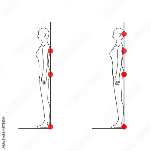 女性　メディカル　姿勢（ストレートネックチェック） 美容　裸　ヌード　全身　側面