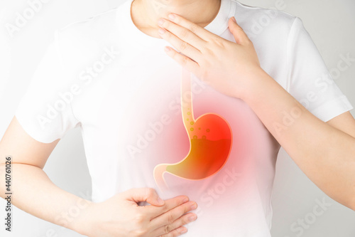 Gastroesophageal reflux disease (GERD) or acid reflux symptoms. Woman suffering from heartburn, stomachache, nausea and bloating. Gastrointestinal system disease and digestive problems. photo