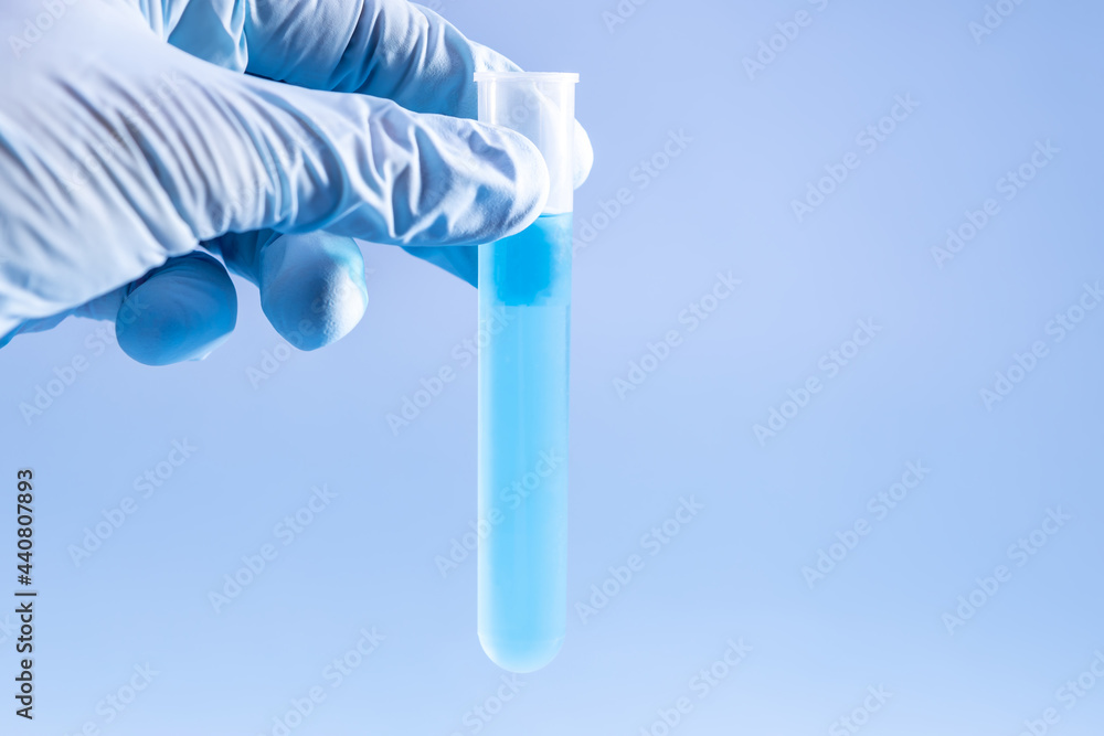 chemical test tube in hand on black background chemical test tube in hand on black background