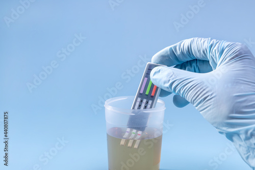 a woman's hand drops test strips into a jar of urine to detect illegal drugs and alcohol in the human body photo