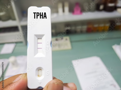 Rapid test cassette for Syphilis test(TPHA) ,The result showed Positive