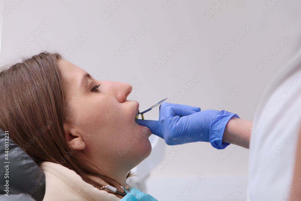 Orthodontist makes a cast of the patient's teeth.Bite correction. Incorrect growth of teeth. Hands in protective gloves. Out of focus.Side view. Orthodontist makes a cast of the patient's teeth.Bite correction. Incorrect growth of teeth. Hands in protective gloves. Out of focus.Side view.