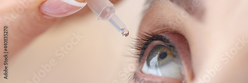 Woman drips eye drops into her eyes