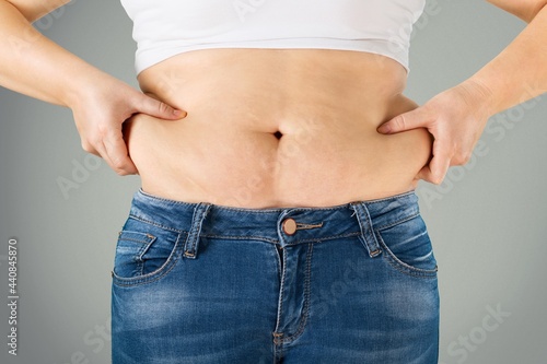 Woman in jeans and shirt squeezing her belly fat. Dieting and fat loss concept. © BillionPhotos.com