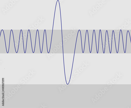Spirometry Curve analyses. Illustration of spirometry curves.