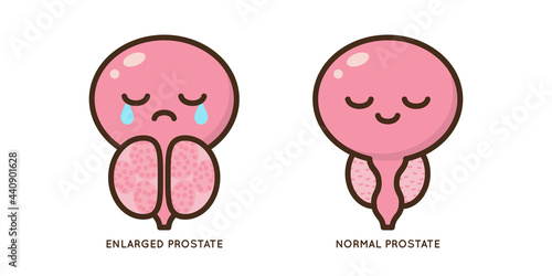 Male prostate disease vector icon flat illustration