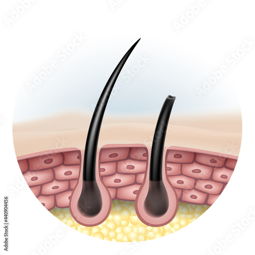 Complete comparison of hair Shine with damaged hair and split ends.
Use instead of pores showing the side images of skin cells and fat layer. EPS Realistic file.