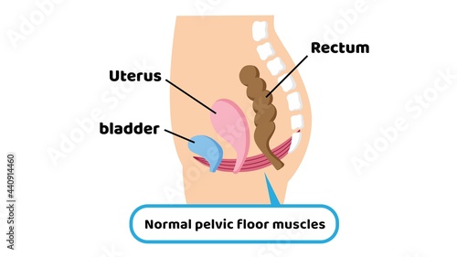 Medical illustration of pelvic floor muscles