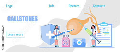Gallbladder concept vector. Doctors treat gallstones. Biliary dyskinesia