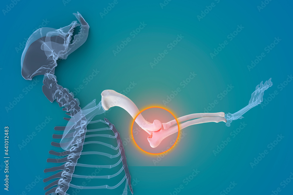 Image showcasing Canine Arthritis and Osteoarthritis joint inflammation Stock ...