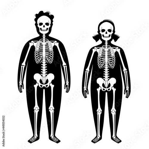 Obese skeleton anatomy