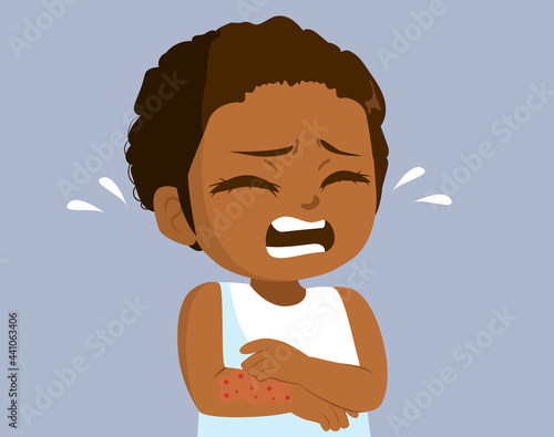 Black little girl scratching her arm rash problem concept