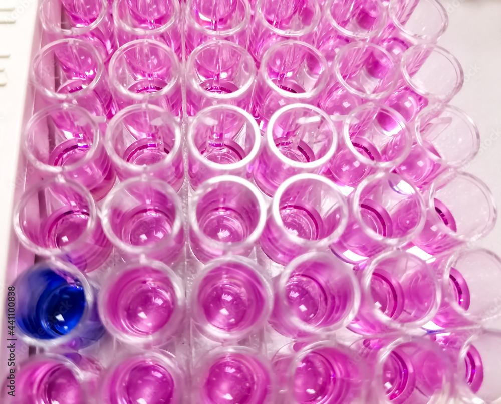 Enzyme-linked Immunosorbent assay (ELISA) plate, Immunology or serology testing method in medical laboratory,HBsAg test,show some positive result