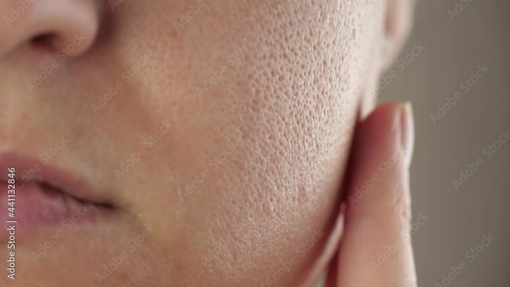 Macro skin with enlarged pores. A woman touches the problem skin with her fingers. Skin with enlarged pores. Skin health. Macro skin with enlarged pores. A woman touches the problem skin with her fingers. Skin with enlarged pores. Skin health.