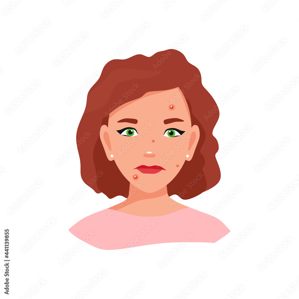 A girl with problematic skin. Vector illustration. A girl with problematic skin. Vector illustration.