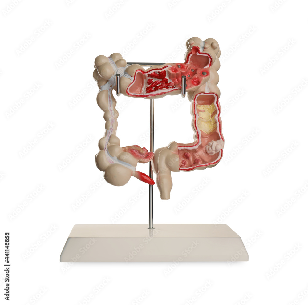 Anatomical model of large intestine isolated on white. Gastroenterology Anatomical model of large intestine isolated on white. Gastroenterology