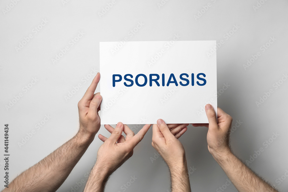 Men holding card with word PSORIASIS on light background, closeup Men holding card with word PSORIASIS on light background, closeup