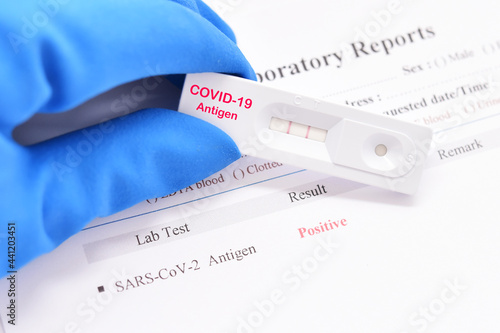 COVID-19 positive test result by using rapid card test for COVID-19 antigen  photo