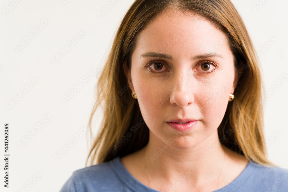 Tired young woman with conjunctivitis Tired young woman with conjunctivitis