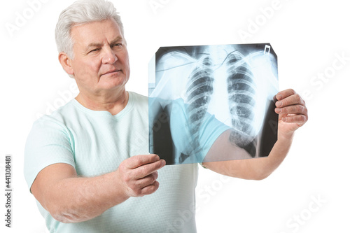 Photography Senior man with x-ray image of lungs on white background