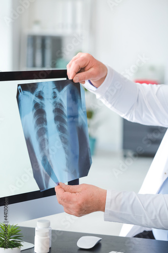Pulmonologist with x-ray im...