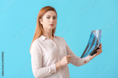 Woman with x-ray image of l...