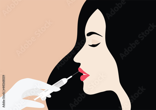 Doctor in medical gloves with serum syringe injects filler to lip of woman vector illustration. Plastic, aesthetic cosmetology beauty treatment concept