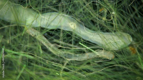 Worm Aeolosoma sp. and Microstomum lineare under a microscope. They live in fresh water, feed on detritus, algae, microorganisms. They move in algae photo