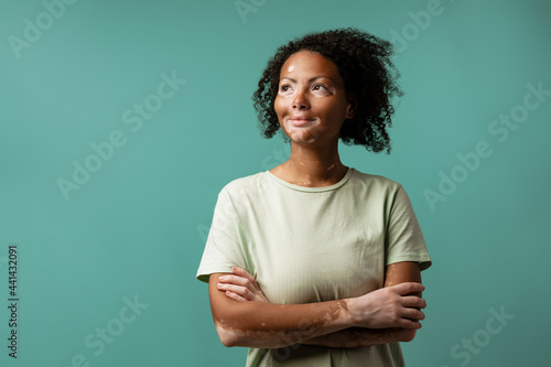 Young woman with vitiligo smiling while posing with arms crossed photo