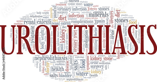 Urolithiasis vector illustration word cloud isolated on a white background.