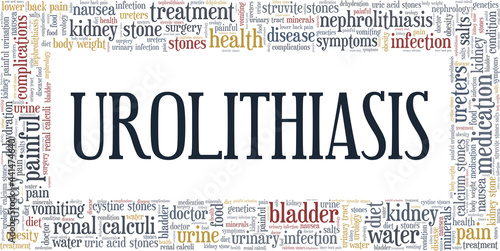 Urolithiasis vector illustration word cloud isolated on a white background.