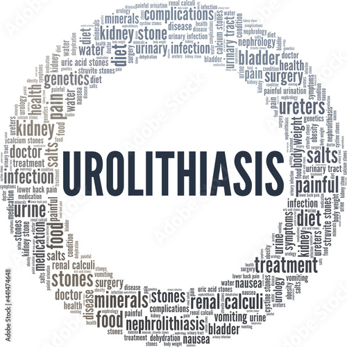 Urolithiasis vector illustration word cloud isolated on a white background.