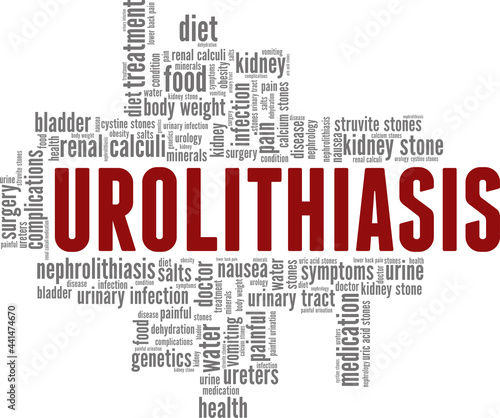 Urolithiasis vector illustration word cloud isolated on a white background.
