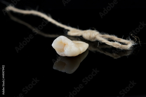 Human tooth after extraction with roots tied with a thread on a black background.