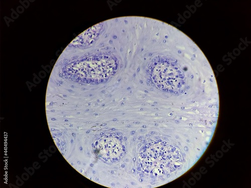 Photo of Squamous hyperplasia from oral mucosa sample, magnification 200x, photo under microscope photo