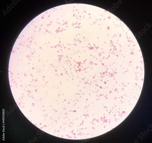 Bacteria cell in Gram stain.