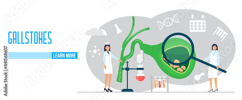 Gallbladder concept vector. Doctors treat gallstones. Web, landing page