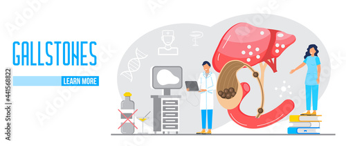 Gallbladder concept vector. Doctors treat gallstones. Web, landing page