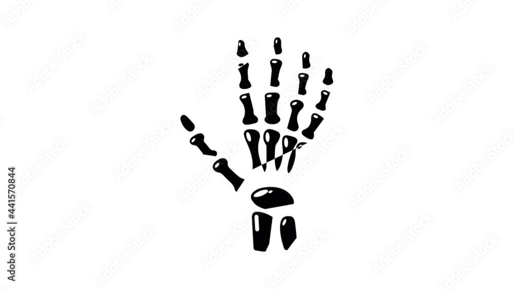 Inflammation of hand icon animation simple best object on white Inflammation of hand icon animation simple best object on white