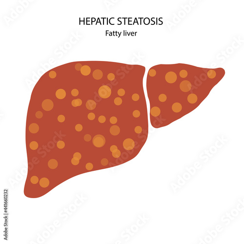 Liver disease concept
