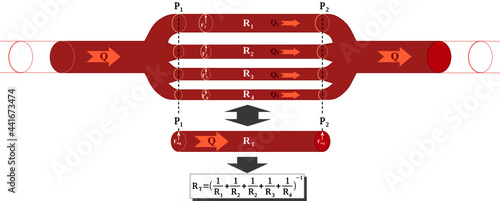 Resistance of a network of parallel vessels