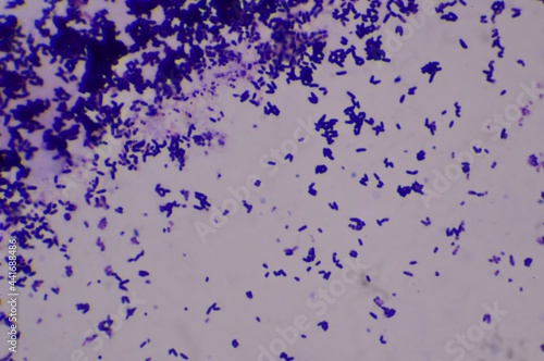 Gram positive baclli chines letter finding with microscope.