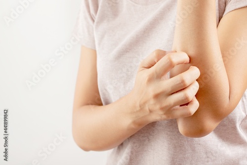 Woman itchy arm due to allergy to skin lotion.
