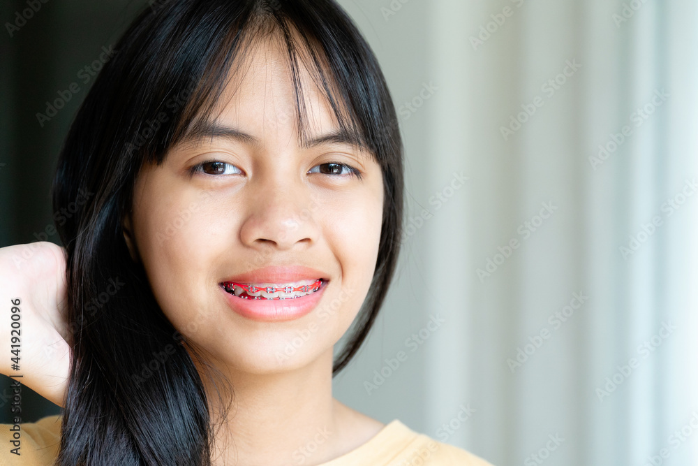 Dental Brace Girl Smiling and Looking to Camera, She Feel Happy and Have Good Attitude with Dentist. Motivate Kids not Fear When they have to go to Dental Clinic. Dental Brace Girl Smiling and Looking to Camera, She Feel Happy and Have Good Attitude with Dentist. Motivate Kids not Fear When they have to go to Dental Clinic.