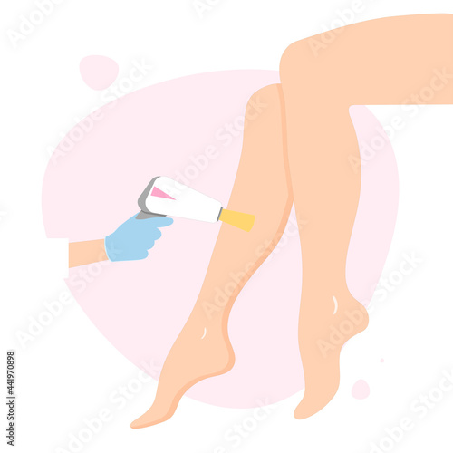 Laser hair removal of the legs