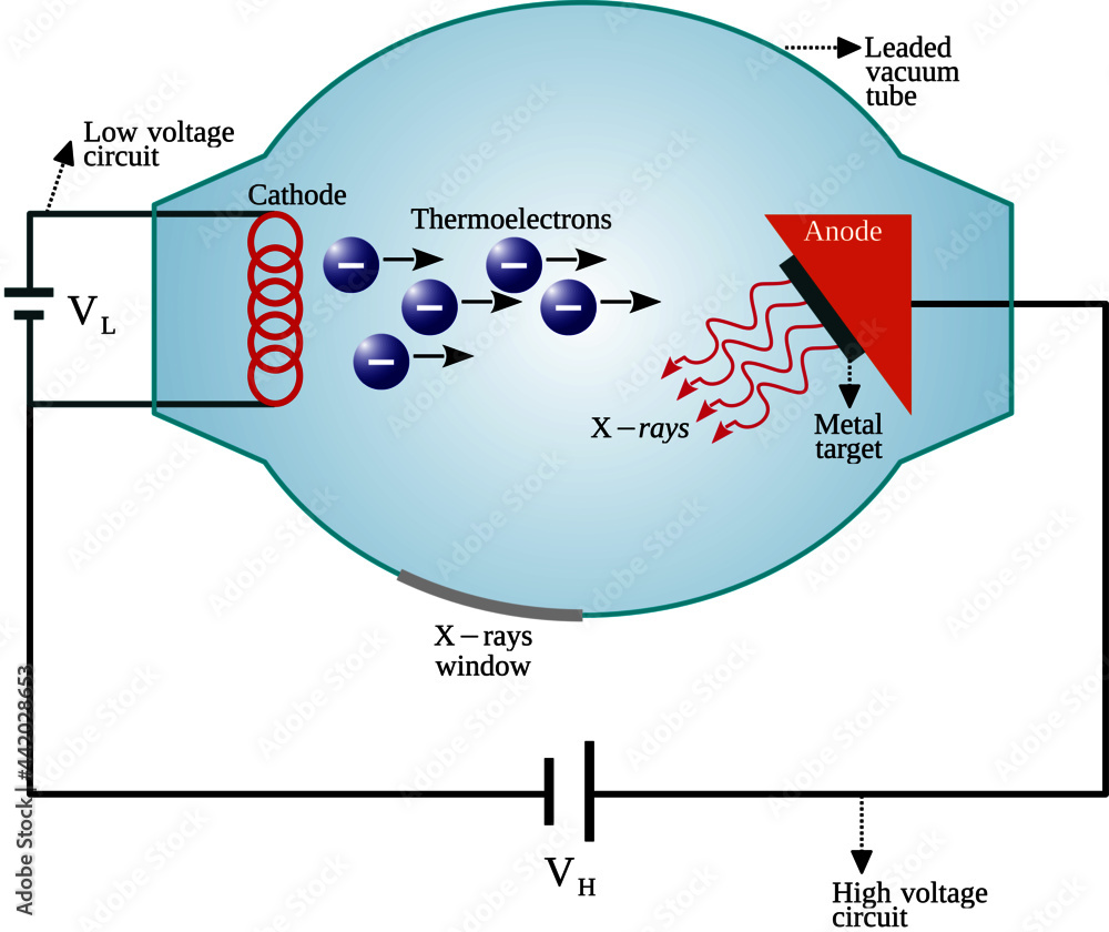 An xray tube is a transducer that convert electrical energy into two