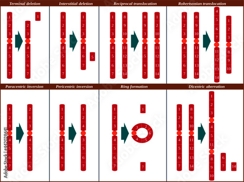 Schematic illustration of common chromosomal aberrations in humans